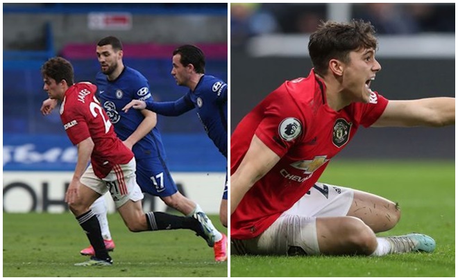 Vẫn uất ức vì hòa Chelsea, HLV Ole lên tiếng: ‘Họ liên tục đá vào chân James’